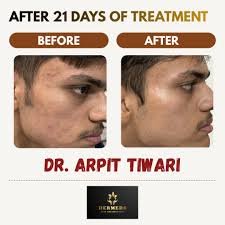 Skin Care Treatment